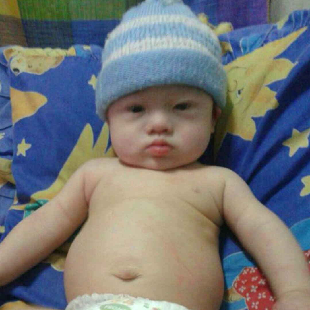 An Australian Couple Abandoned Their Baby with Down Syndrome, So the